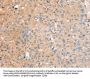 Rabbit anti-human RASAL2 polyclonal antibody