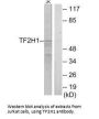 GTF2H1 Antibody