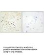 GTF2H1 Antibody