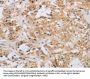 RAD54L2 Antibody