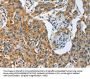 Rabbit anti-human TNFSF13 polyclonal antibody