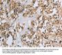 IL5RA Antibody