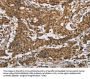 IL5RA Antibody