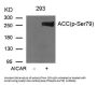 Phospho-ACACA (Ser79) Antibody