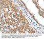SCN2A Antibody