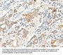 SCN2A Antibody