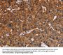 LAMP2 Antibody