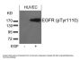 Phospho-EGFR (Tyr1110) Antibody