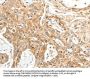 TPM2 Antibody
