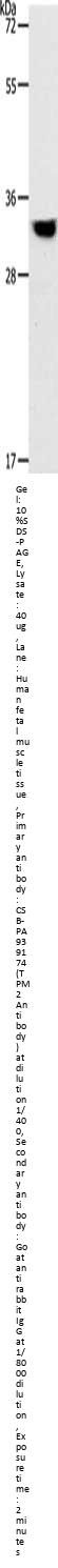 TPM2 Antibody