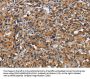 CEACAM1 Antibody