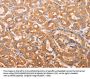 ADH1B Antibody