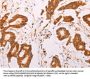 ADH1B Antibody