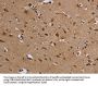 KCNK13 Antibody