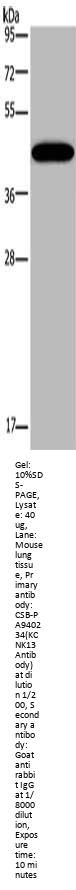 KCNK13 Antibody