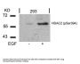 Phospho-HDAC2 (Ser394) Antibody