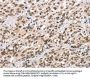 Rabbit anti-human CCNT1 polyclonal antibody