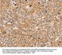 CCL16 Antibody