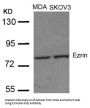 EZR (Ab-353) Antibody