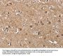 BUB1 Antibody