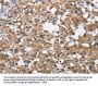 BUB1 Antibody
