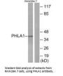 PHLDA1 Antibody