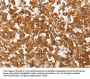 PLA2G4A Antibody