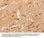 PLA2G4A Antibody