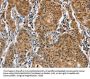 CAT Antibody