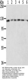 RNF20 Antibody