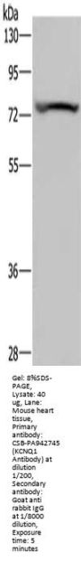 KCNQ1 Antibody