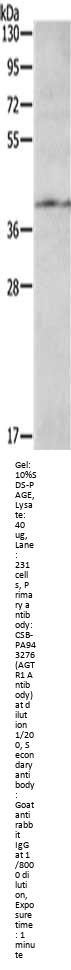 AGTR1 Antibody