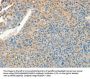 CHRDL2 Antibody