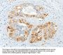 CHRDL2 Antibody