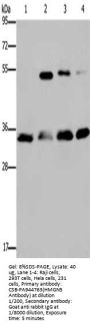 HMGN5 Antibody
