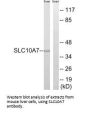 SLC10A7 Antibody