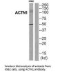 ACTN1 Antibody