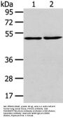 Rabbit anti-human TBC1D22A polyclonal antibody
