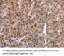 Rabbit anti-human GPHN polyclonal antibody