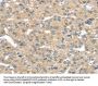 TUSC2 Antibody