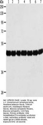 ACTIN Antibody