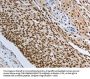 PRMT3 Antibody