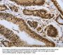 PRMT3 Antibody