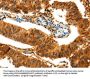 PARK7 Antibody
