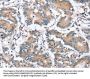 PLCZ1 Antibody