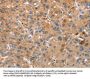 PLIN2 Antibody