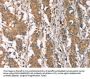 PLIN2 Antibody