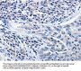 CCNE1 Antibody