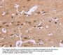CDK1 Antibody