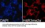 Histone H4R3me2a Antibody